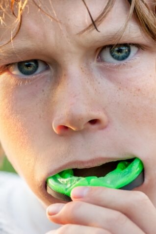 Young boy placing green athletic mouthguard into his mouth