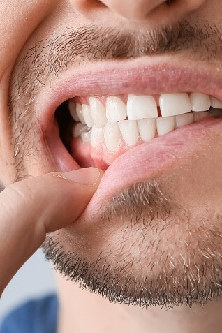 Close up of a man pointing to his gums