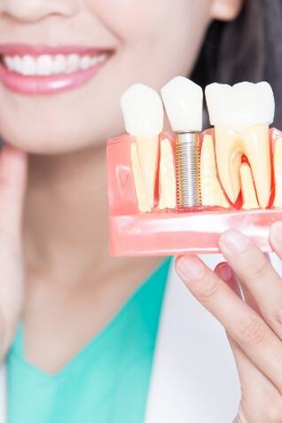 Dentist holding a dental implant model