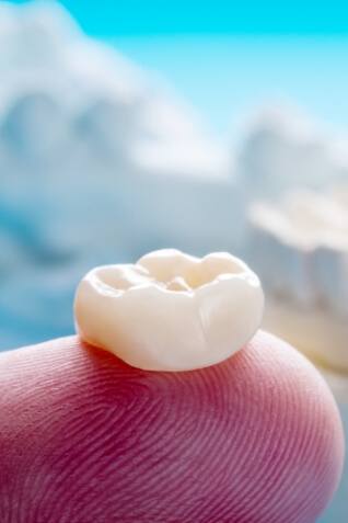 Dental crown resting on a finger